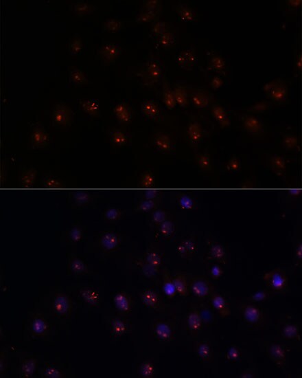 METT10D Antibody