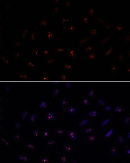 METT10D Antibody