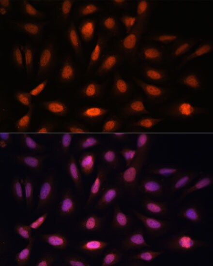 PPIL4 Antibody