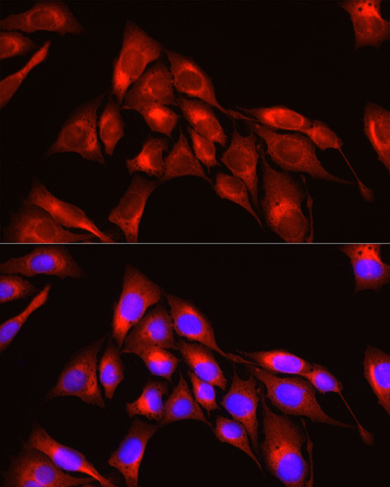 TRIM4 Antibody