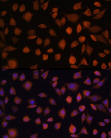 ARMC6 Antibody