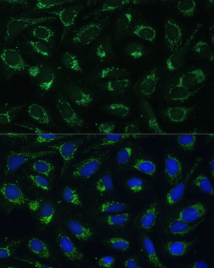 ETFB Antibody