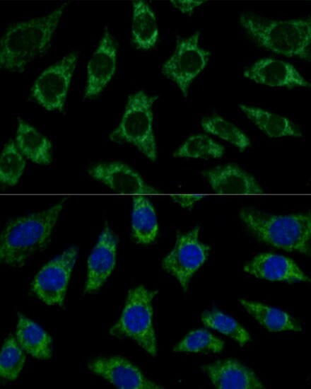 ETFB Antibody
