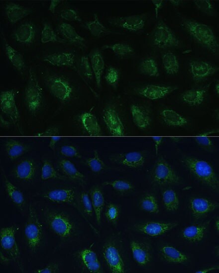GRF2 Antibody