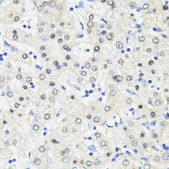 TRIM27 Antibody