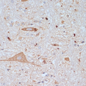 VAChT/SLC18A3 Antibody