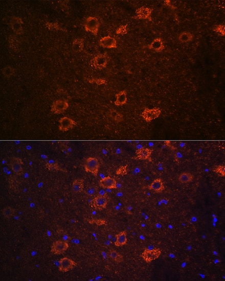 VAChT/SLC18A3 Antibody