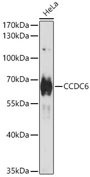 CCDC6 Antibody