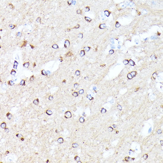 CCDC6 Antibody