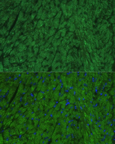 Atrial Natriuretic Peptide/ANP Antibody