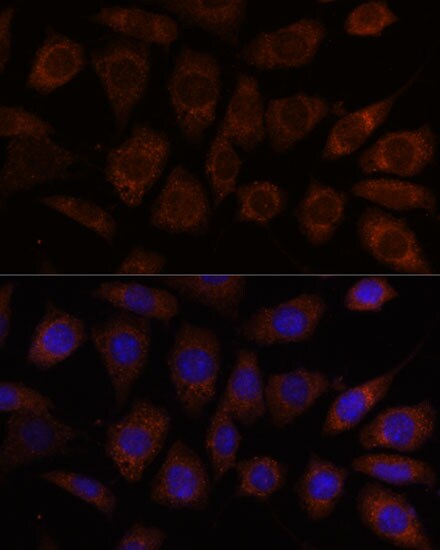 SEC24D Antibody