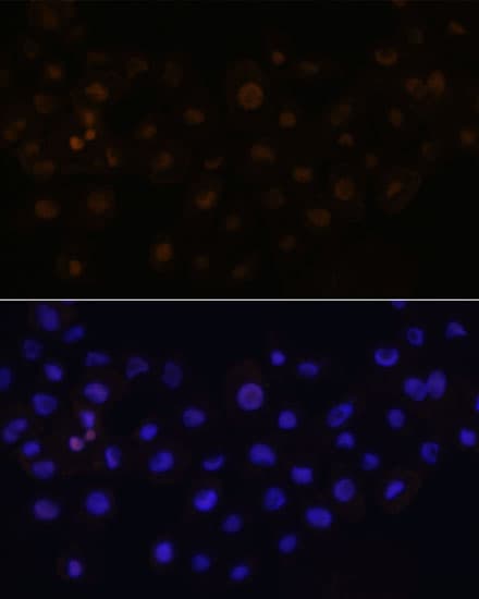 HEY1 Antibody