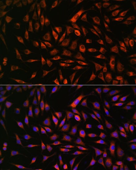 EML4 Antibody