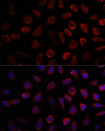 PDE11A Antibody