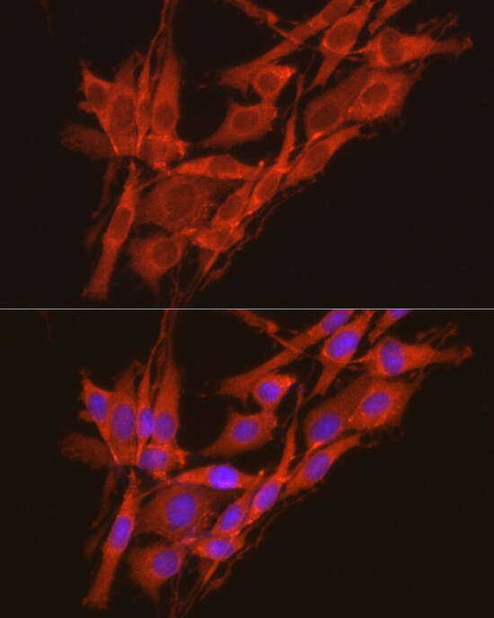 CKII alpha prime polypeptide Antibody