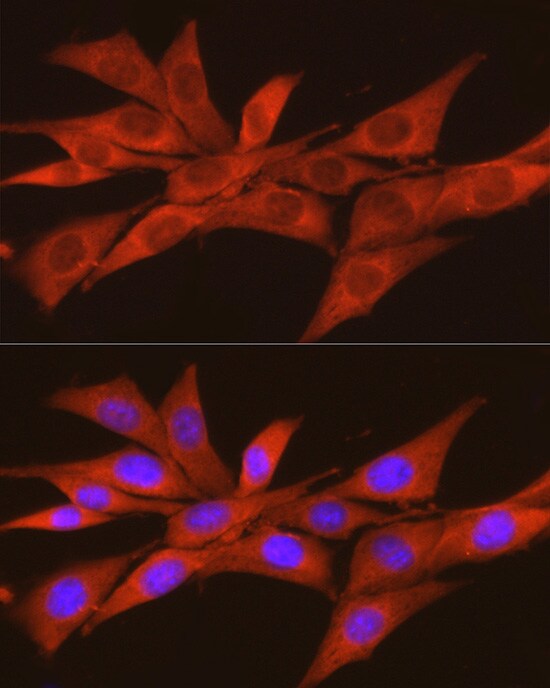 CKII alpha prime polypeptide Antibody