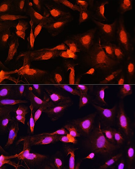 Shugoshin Antibody