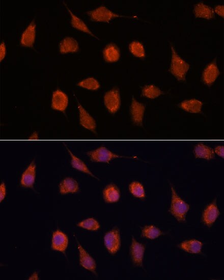 KvBeta2 Antibody
