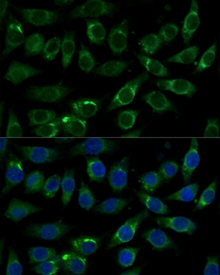 FALDH Antibody