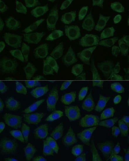 DDX6 Antibody