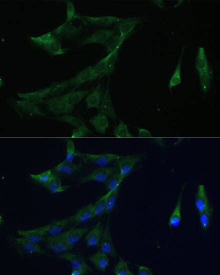 ARL3 Antibody