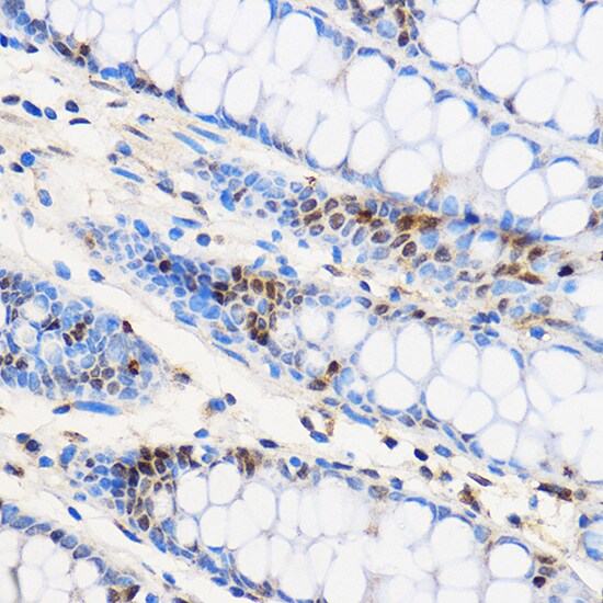 ZNF263 Antibody