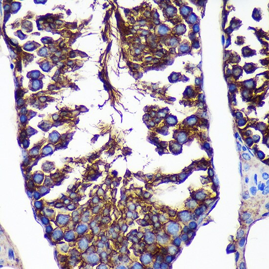 CTNNA3 Antibody