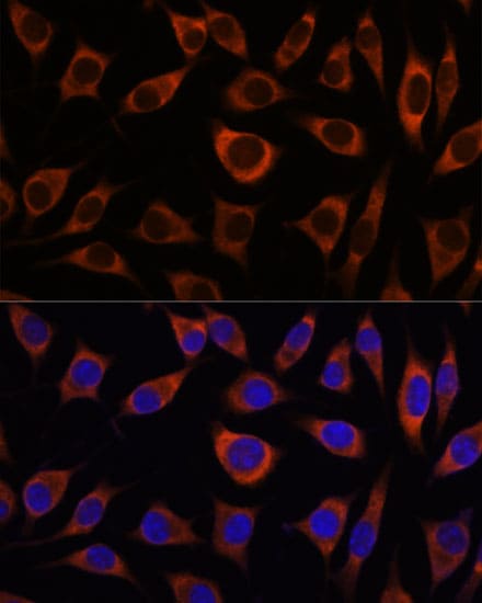CTNNA3 Antibody