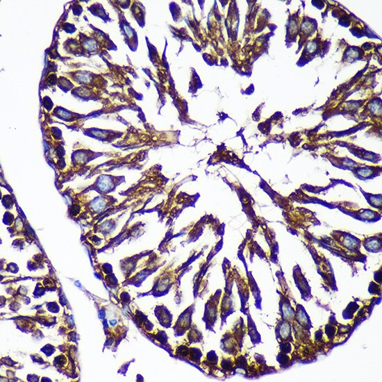 CTNNA3 Antibody