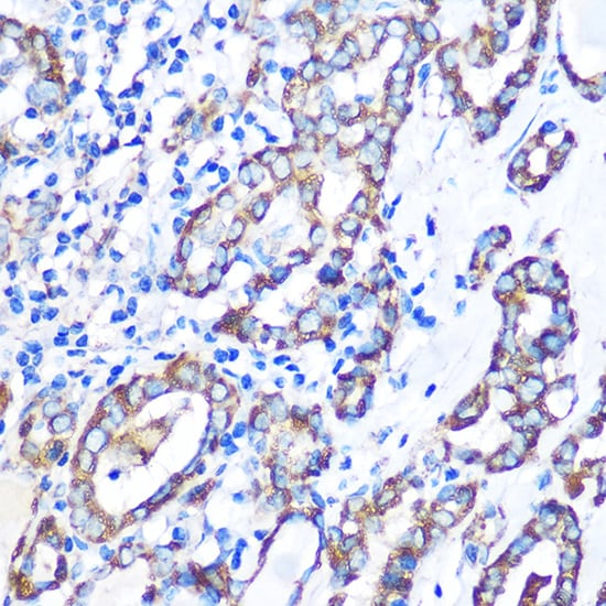 MST4 Antibody