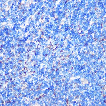 MST4 Antibody