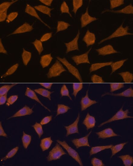 Septin-3 Antibody