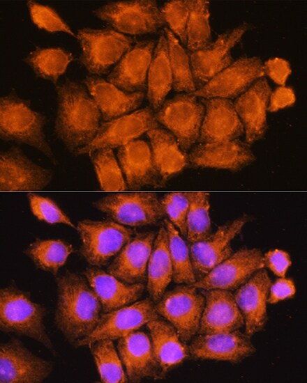 CCDC11 Antibody