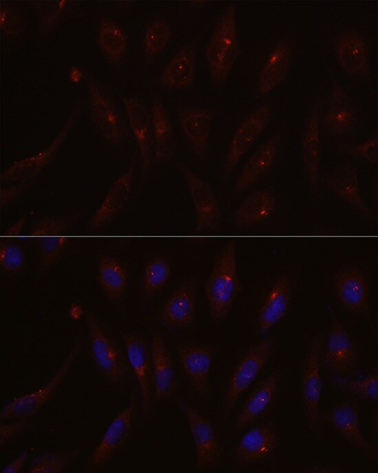PCM1 Antibody