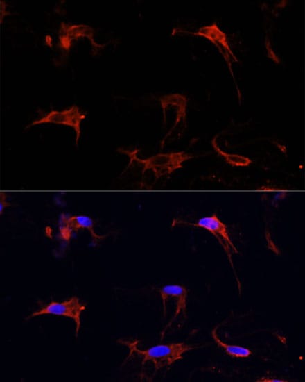 Fibrillin 1 Antibody