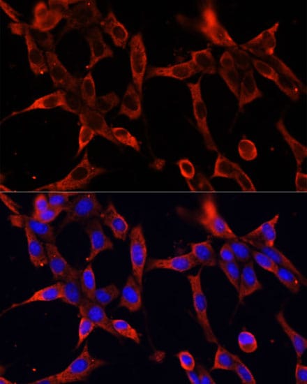 Fibrillin 1 Antibody