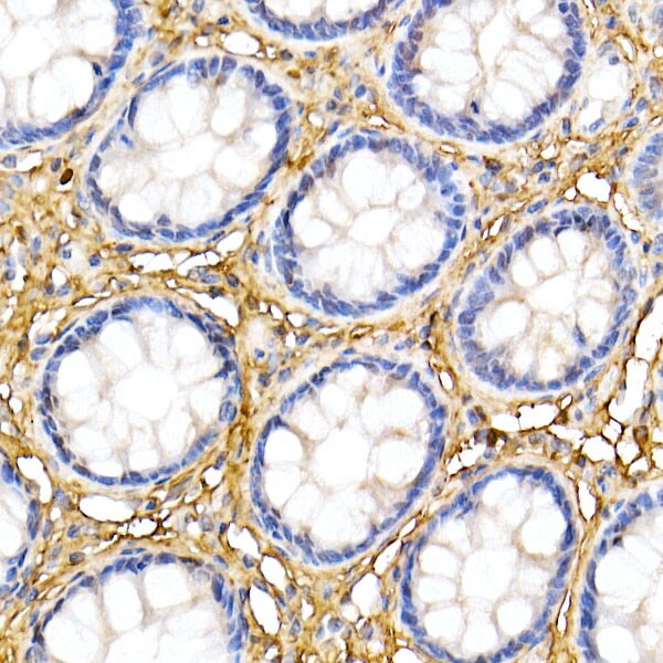 Decorin Antibody