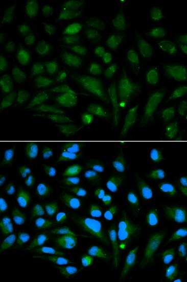 Decorin Antibody