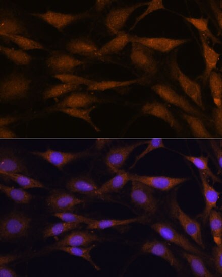 TFAP4 Antibody