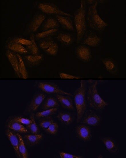 TFAP4 Antibody