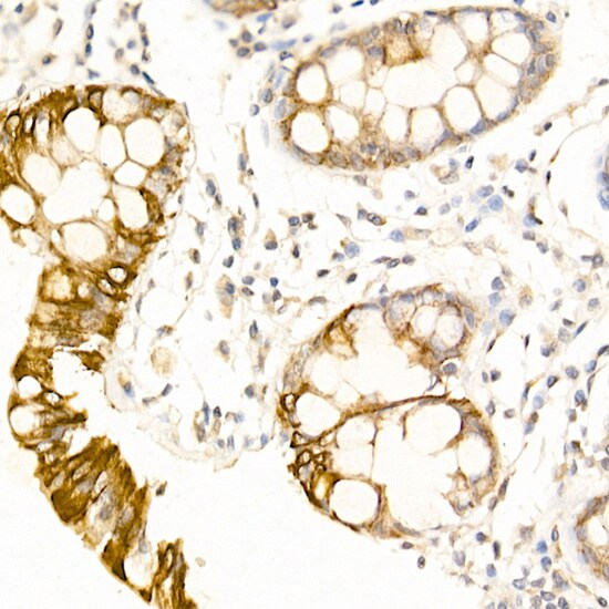 USP18 Antibody