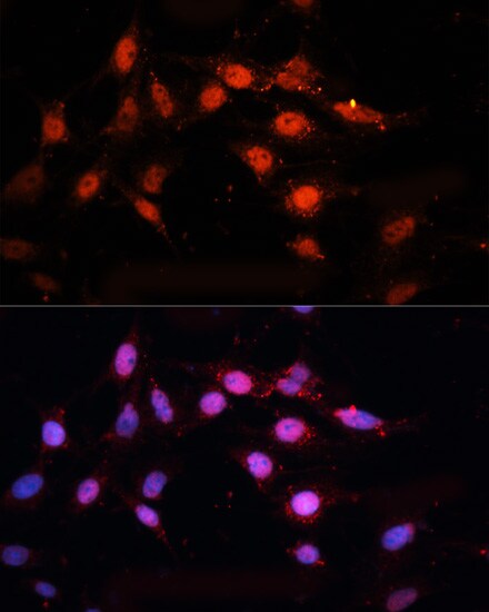 CTBP2 Antibody