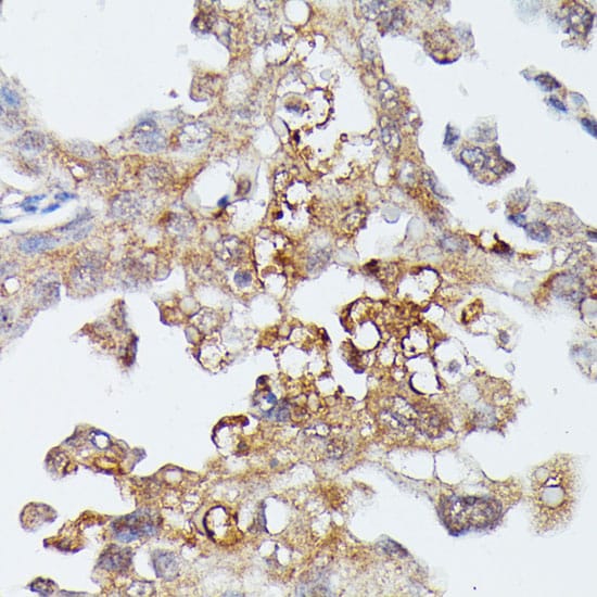 MEKK4 Antibody
