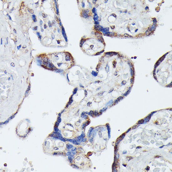MEKK4 Antibody