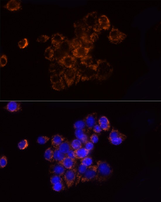 Ndufs1 Antibody