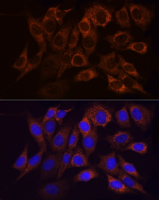 Ndufs1 Antibody