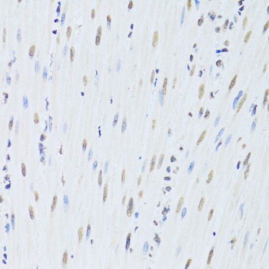 hnRNP K Antibody