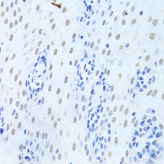 hnRNP K Antibody