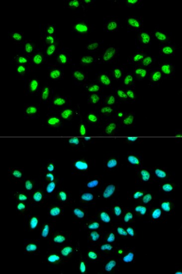 hnRNP K Antibody