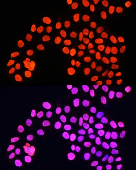 H4 Clustered Histone 1 Antibody